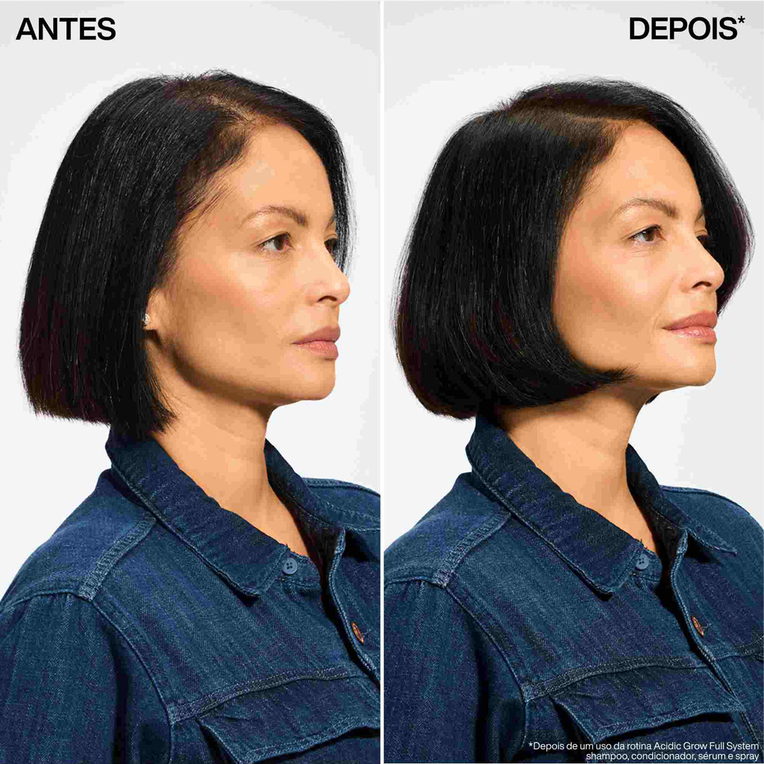 Redken Scalp anti-hair loss aminexil 10x6ml